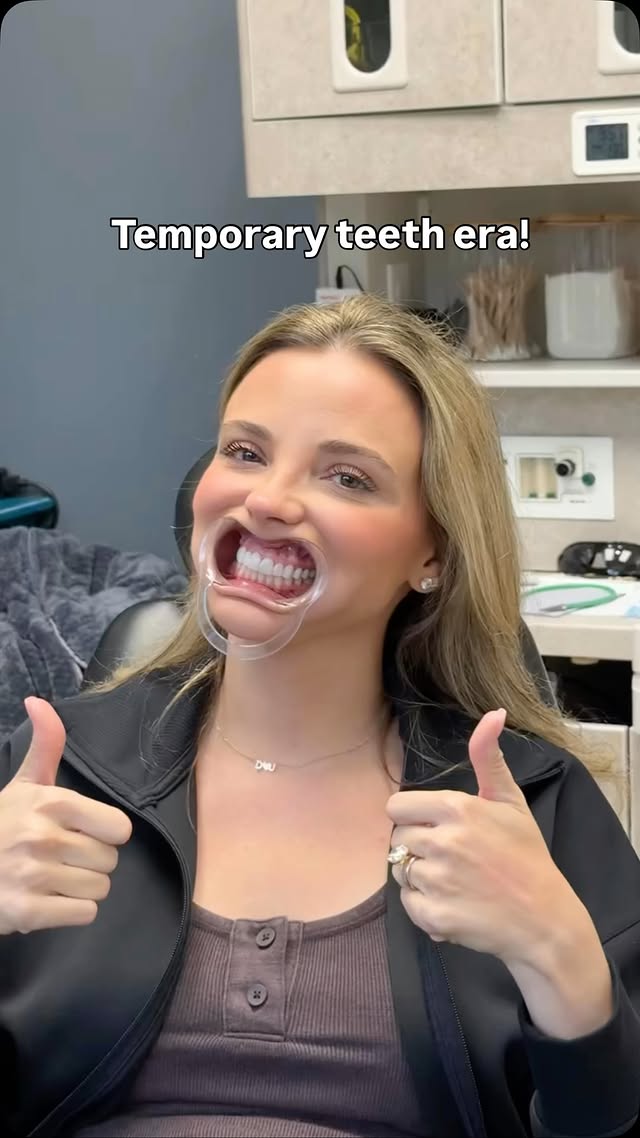 operation hot mom loading 🤪🦷okay so here’s the deal…I’ve been wanting teeth done for awhile now. after 4 babies I was like yeah… I deserve this one 😂 I started getting a gap between my front teeth + some discoloration (and this implant has been holding on for 17 years 😅) so it was timeeeeI did sooo much research and found @doctor.dooley at @smiletexas_houston and she’s AMAZING!! today was the prep appointment — all the scans, molds, and getting everything perfect for my custom veneers. I’m in temporaries now and they actually look SO much like real teeth which is wild!! So now, I go back in 2 weeks to get my final veneers and I cannot wait to see them!!stay tuned for the final look!!!😁 by @daniaustin