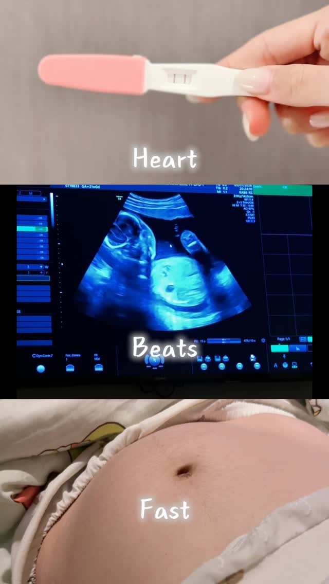 我們的世界💕多了一位新成員👶🏻🫶🏻🪄

#櫻桃姐姐 #懷孕 #25w1d #懷孕日記
